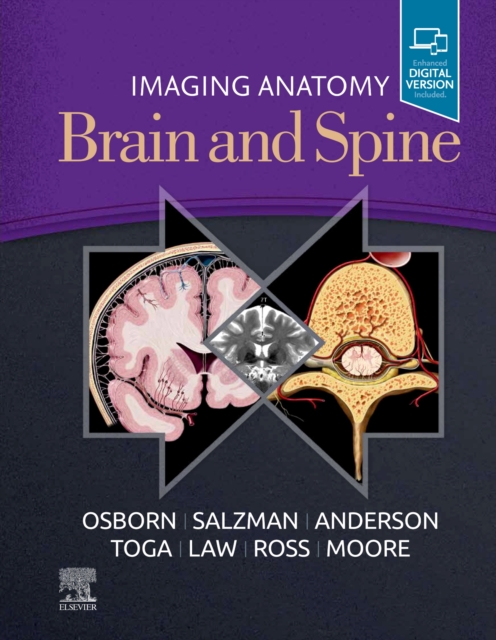 Imaging Anatomy Brain and Spine, Hardback Book