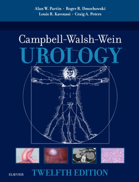 Campbell Walsh Wein Urology, E-Book : 3-Volume Set, EPUB eBook
