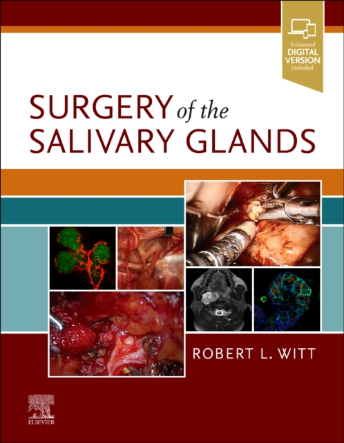 Surgery of the Salivary Glands, Hardback Book