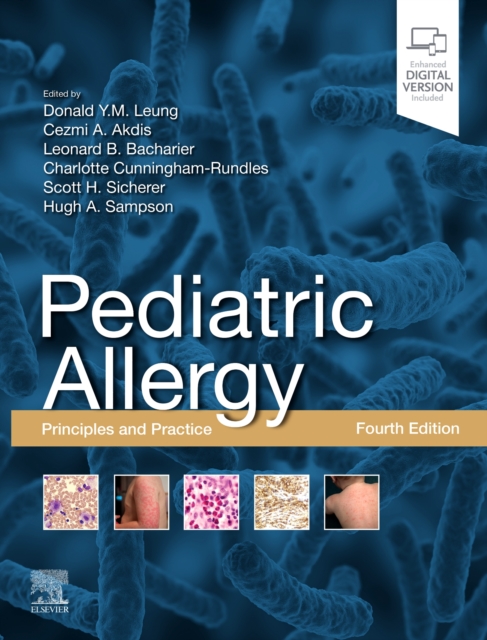 Pediatric Allergy: Principles and Practice : Principles and Practice, Hardback Book