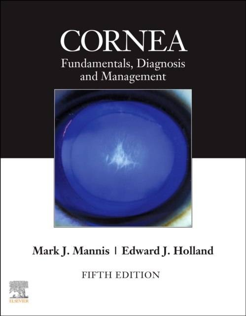 Cornea, E-Book, EPUB eBook