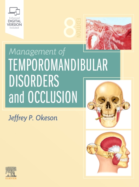 Management of Temporomandibular Disorders and Occlusion, Hardback Book