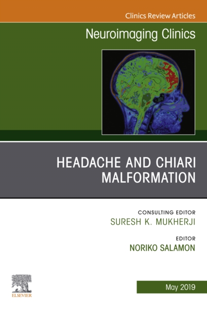 Headache and Chiari Malformation, An Issue of Neuroimaging Clinics of North America, EPUB eBook