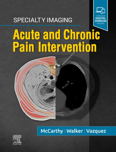 Specialty Imaging: Acute and Chronic Pain Intervention, Hardback Book