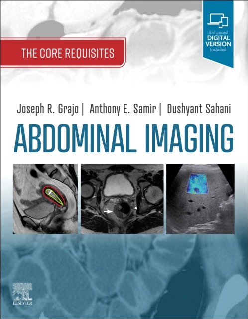 Abdominal Imaging E-Book : The Core Requisites, PDF eBook