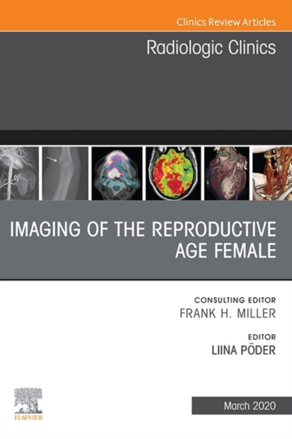 Imaging of the Reproductive Age Female,An Issue of Radiologic Clinics of North America, EPUB eBook