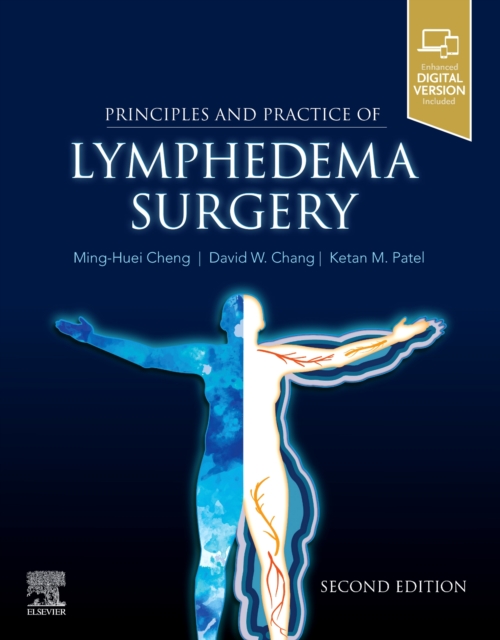 Principles and Practice of Lymphedema Surgery, Paperback / softback Book