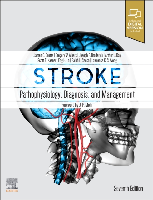 Stroke : Pathophysiology, Diagnosis, and Management, PDF eBook