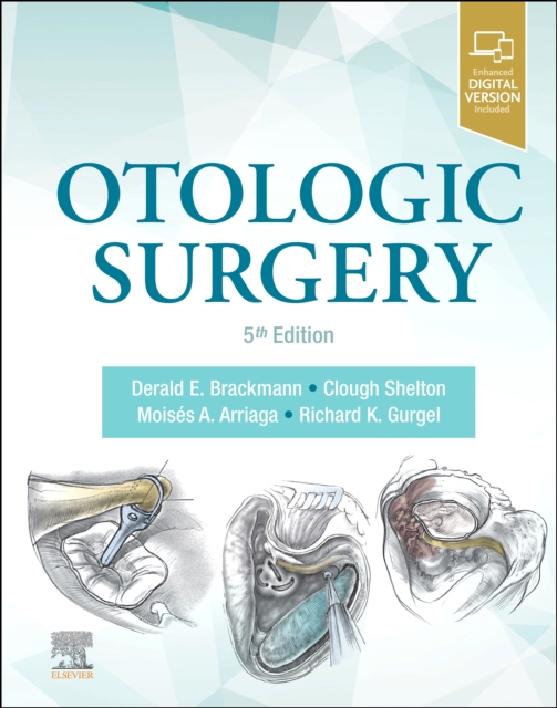 Otologic Surgery E-Book, PDF eBook