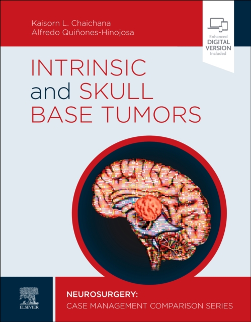 Intrinsic and Skull Base Tumors : Neurosurgery: Case Management Comparison Series, Hardback Book