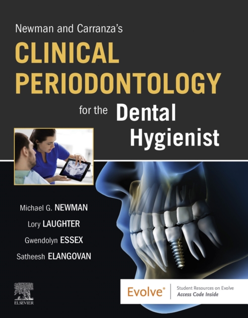Newman and Carranza's Clinical Periodontology for the Dental Hygienist, EPUB eBook