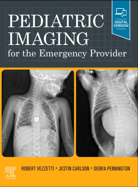 Pediatric Imaging for the Emergency Provider, Hardback Book