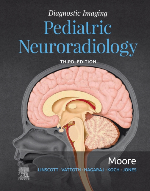 Diagnostic Imaging: Pediatric Neuroradiology E-Book : Diagnostic Imaging: Pediatric Neuroradiology E-Book, EPUB eBook