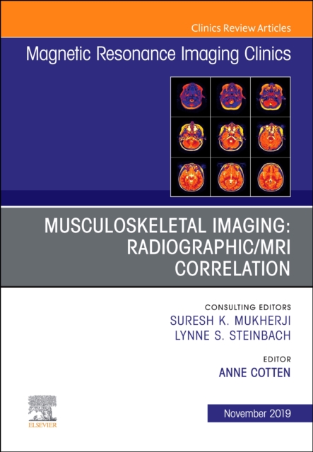 Musculoskeletal Imaging: Radiographic/MRI Correlation, An Issue of Magnetic Resonance Imaging Clinics of North America : Volume 27-4, Hardback Book