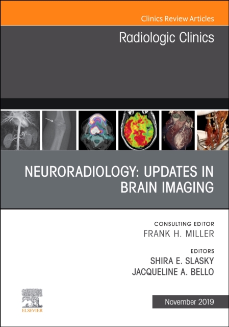 Neuroradiology, An Issue of Radiologic Clinics of North America : Volume 57-6, Hardback Book