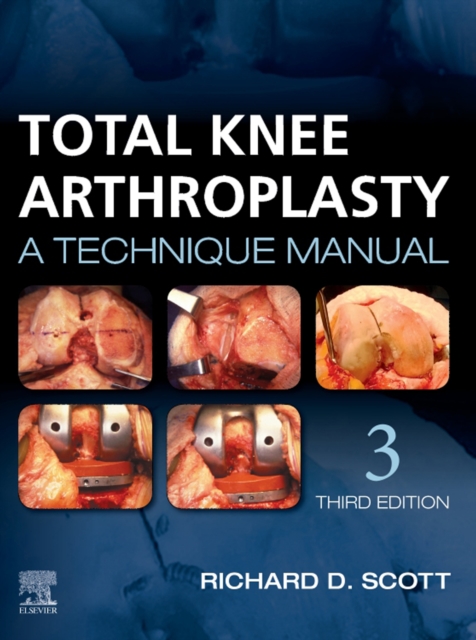 Total Knee Arthroplasty E-Book : A Technique Manual, EPUB eBook