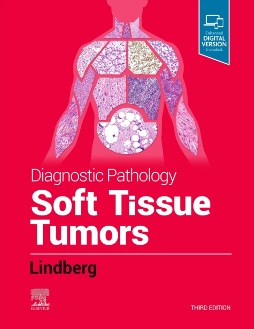 Diagnostic Pathology: Soft Tissue Tumors : Diagnostic Pathology: Soft Tissue Tumors E-Book, EPUB eBook