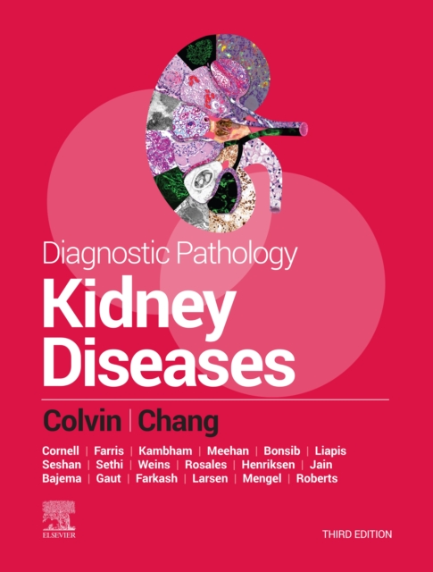 Diagnostic Pathology: Kidney Diseases : Diagnostic Pathology: Kidney Diseases E-Book, EPUB eBook