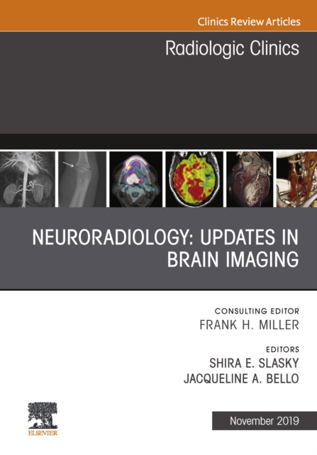 Neuroradiology, An Issue of Radiologic Clinics of North America, EPUB eBook