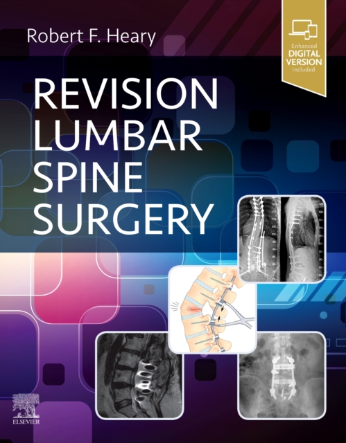 Revision Lumbar Spine Surgery, Hardback Book