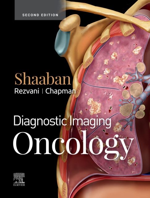 Diagnostic Imaging: Oncology E-Book : Diagnostic Imaging: Oncology E-Book, EPUB eBook