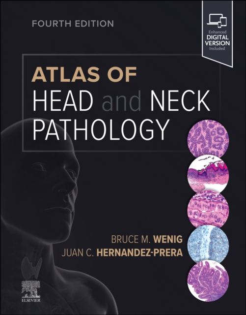 Atlas of Head and Neck Pathology E-Book, EPUB eBook