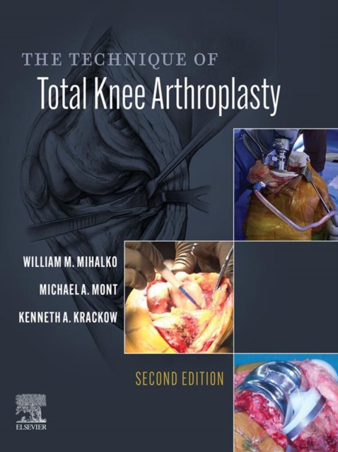 The Technique of Total Knee Arthroplasty, EPUB eBook