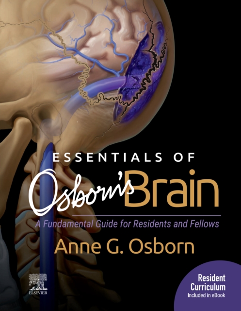Essentials of Osborn's Brain E-Book : Essentials of Osborn's Brain E-Book, EPUB eBook