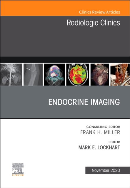 Endocrine Imaging , An Issue of Radiologic Clinics of North America : Volume 58-6, Hardback Book