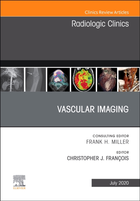 Vascular Imaging, An Issue of Radiologic Clinics of North America : Volume 58-4, Hardback Book