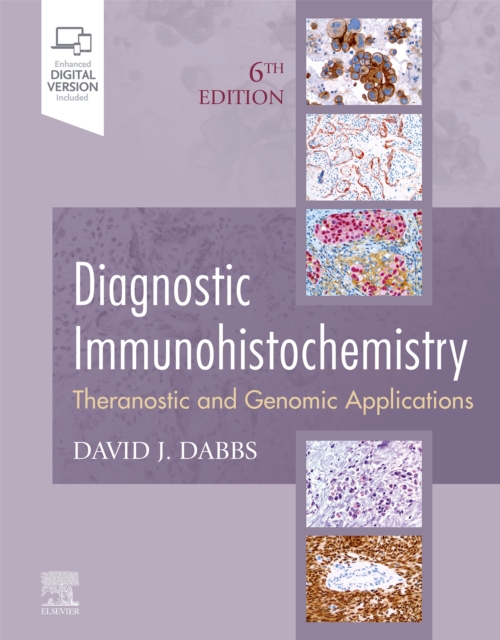 Diagnostic Immunohistochemistry : Diagnostic Immunohistochemistry E-Book, EPUB eBook