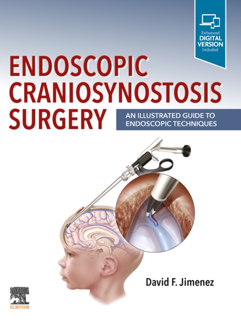 Endoscopic Craniosynostosis Surgery : An Illustrated Guide to Endoscopic Techniques, EPUB eBook