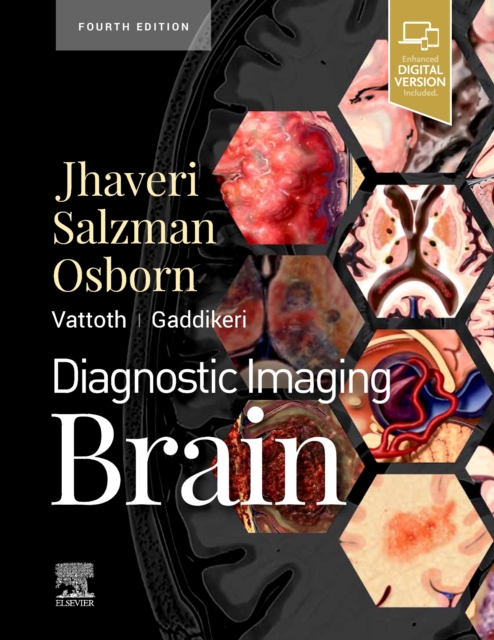 Diagnostic Imaging: Brain, Hardback Book