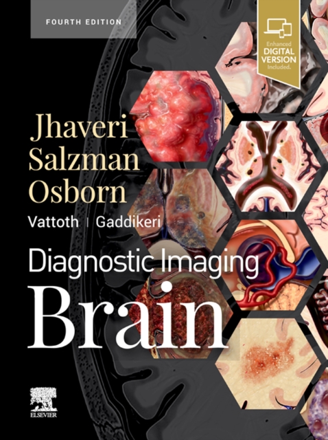 Diagnostic Imaging: Brain E-Book : Diagnostic Imaging: Brain E-Book, EPUB eBook