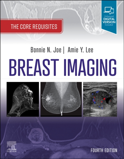Breast Imaging : The Core Requisites, Paperback / softback Book