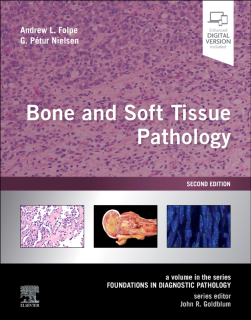 Bone and Soft Tissue Pathology : A volume in the series Foundations in Diagnostic Pathology, Hardback Book