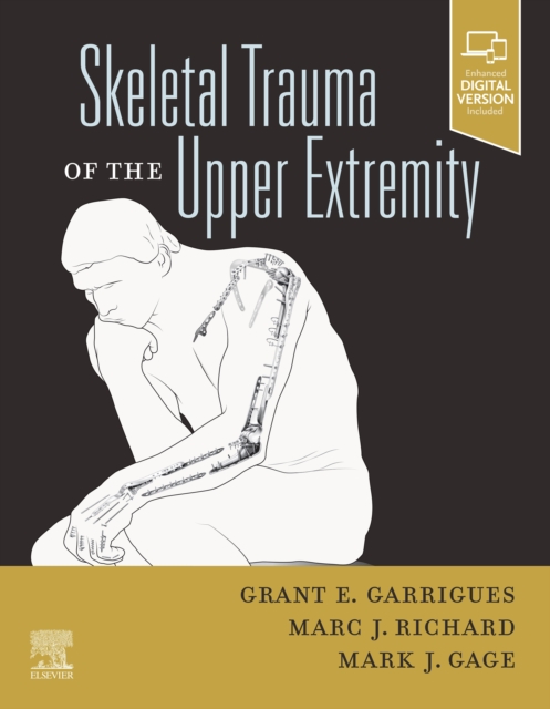 Skeletal Trauma of the Upper Extremity, E-Book, EPUB eBook