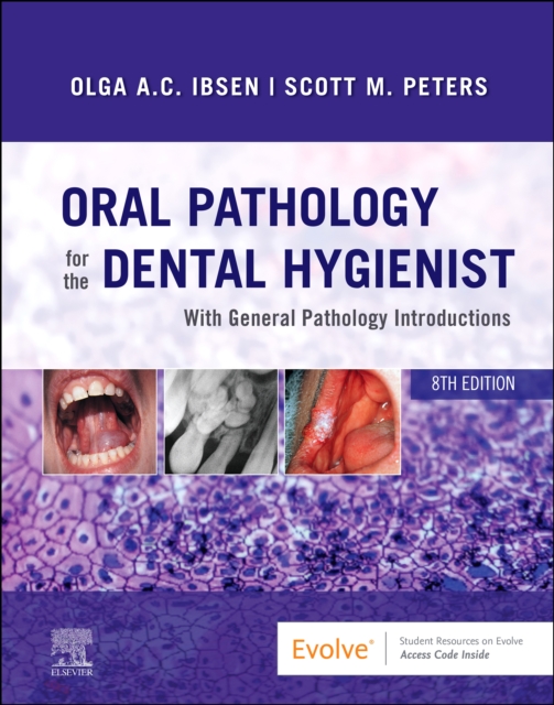 Oral Pathology for the Dental Hygienist E-Book : Oral Pathology for the Dental Hygienist E-Book, EPUB eBook