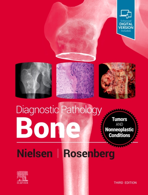 Diagnostic Pathology: Bone, Hardback Book