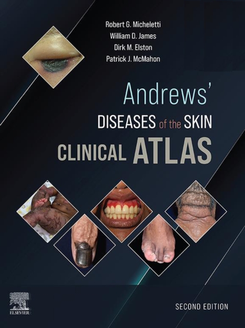 Andrews' Diseases of the Skin Clinical Atlas : Andrews' Diseases of the Skin Clinical Atlas,E-Book, EPUB eBook