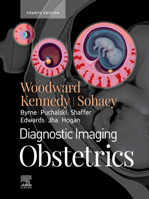 Diagnostic Imaging: Obstetrics E-Book : Diagnostic Imaging: Obstetrics E-Book, EPUB eBook