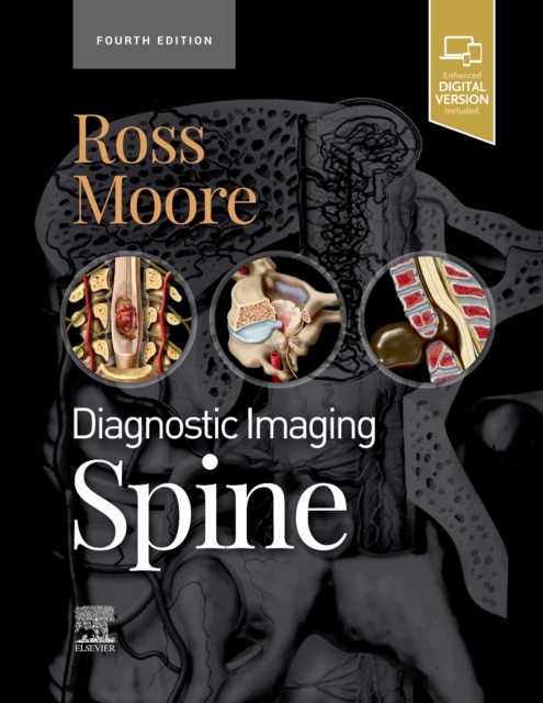 Diagnostic Imaging: Spine, Hardback Book