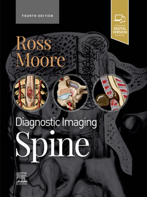 Diagnostic Imaging: Spine - E-Book : Diagnostic Imaging: Spine - E-Book, EPUB eBook