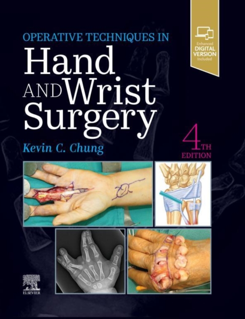 Operative Techniques: Hand and Wrist Surgery E-Book, EPUB eBook