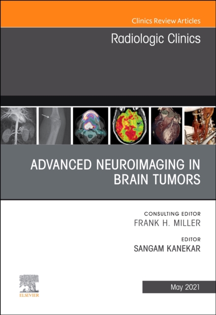 Advanced Neuroimaging in Brain Tumors, An Issue of Radiologic Clinics of North America : Volume 59-3, Hardback Book