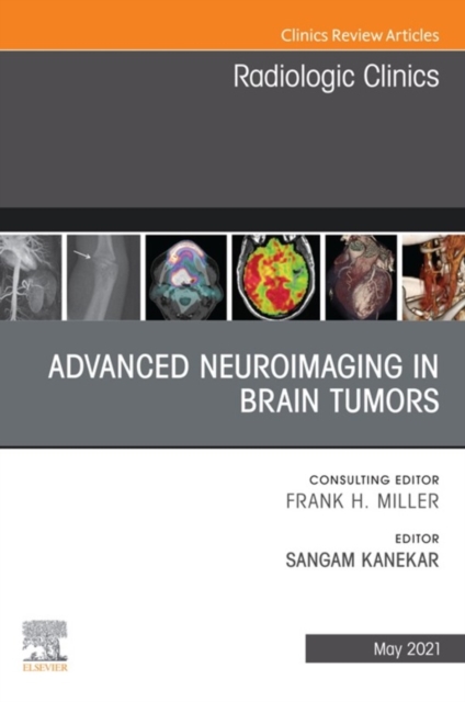 Advanced Neuroimaging in Brain Tumors, An Issue of Radiologic Clinics of North America, E-Book : Advanced Neuroimaging in Brain Tumors, An Issue of Radiologic Clinics of North America, E-Book, EPUB eBook