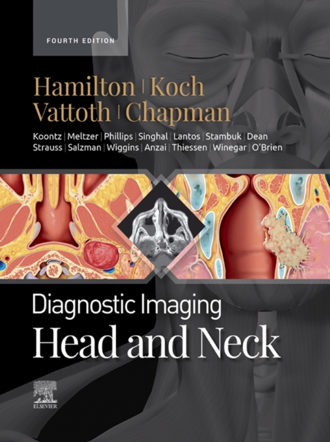 Diagnostic Imaging: Head and Neck - E-Book : Diagnostic Imaging: Head and Neck - E-Book, EPUB eBook