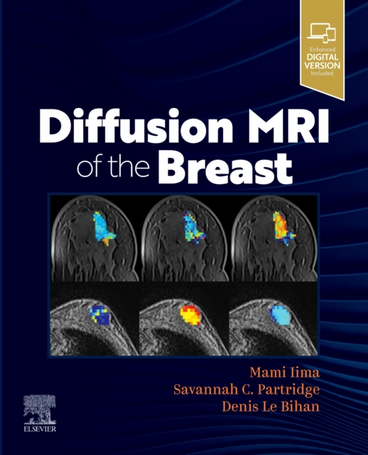 Diffusion MRI of the Breast, Paperback / softback Book