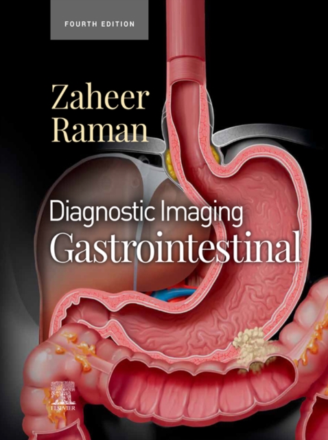 Diagnostic Imaging: Gastrointestinal - E-Book : Diagnostic Imaging: Gastrointestinal - E-Book, EPUB eBook