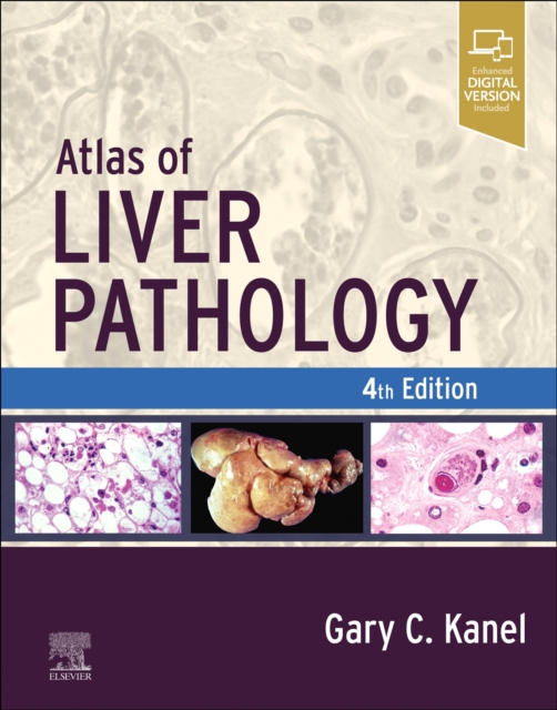 Atlas of Liver Pathology, Hardback Book